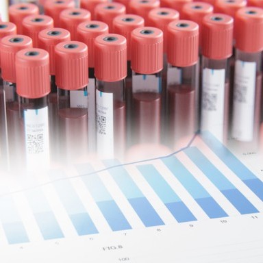 New SCTO Platforms seminar series: Facts and pitfalls of observational studies – How to plan and conduct HRO projects